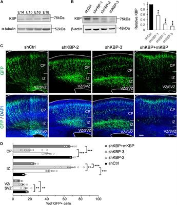 Multiple Functions of KBP in Neural Development Underlie Brain Anomalies in Goldberg-Shprintzen Syndrome